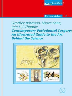 cover image of Contemporary Periodontal Surgery